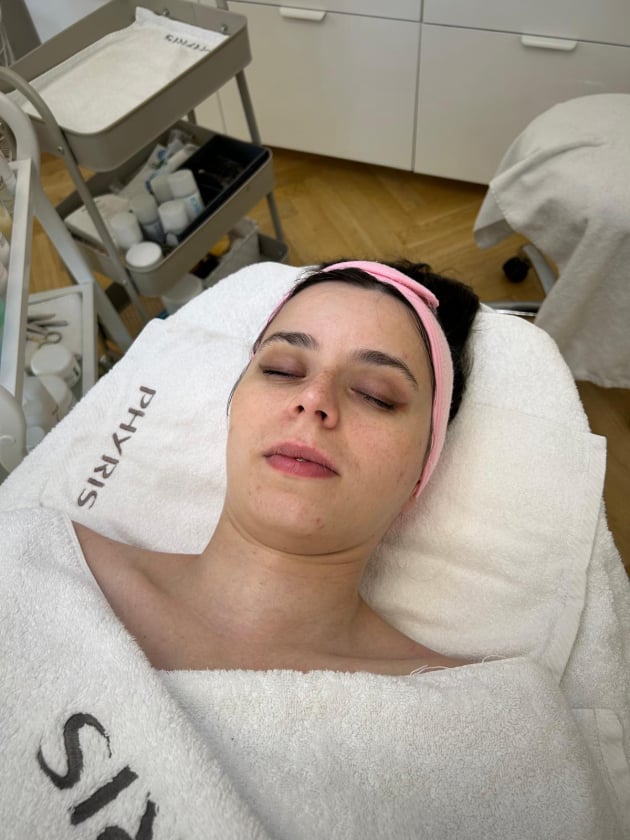 Klientka po ošetření